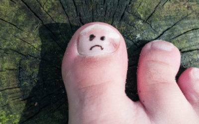 Fungal Toenail Treatments