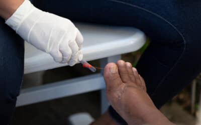 How Diabetes Affects Your Feet
