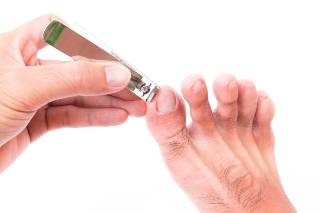 How to clip your toenails to prevent an ingrown toenail