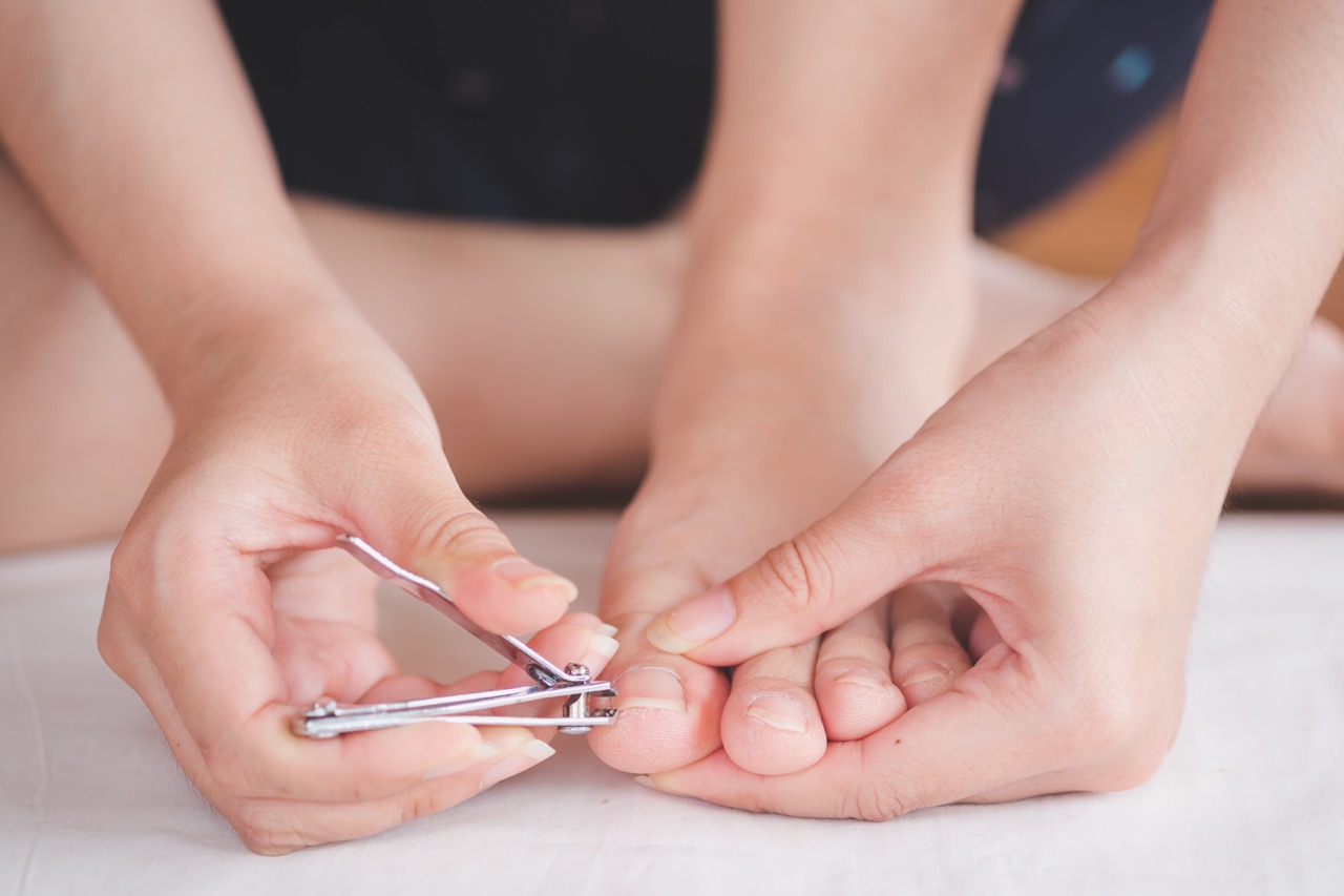 How to clip your toenails to prevent an ingrown toenail