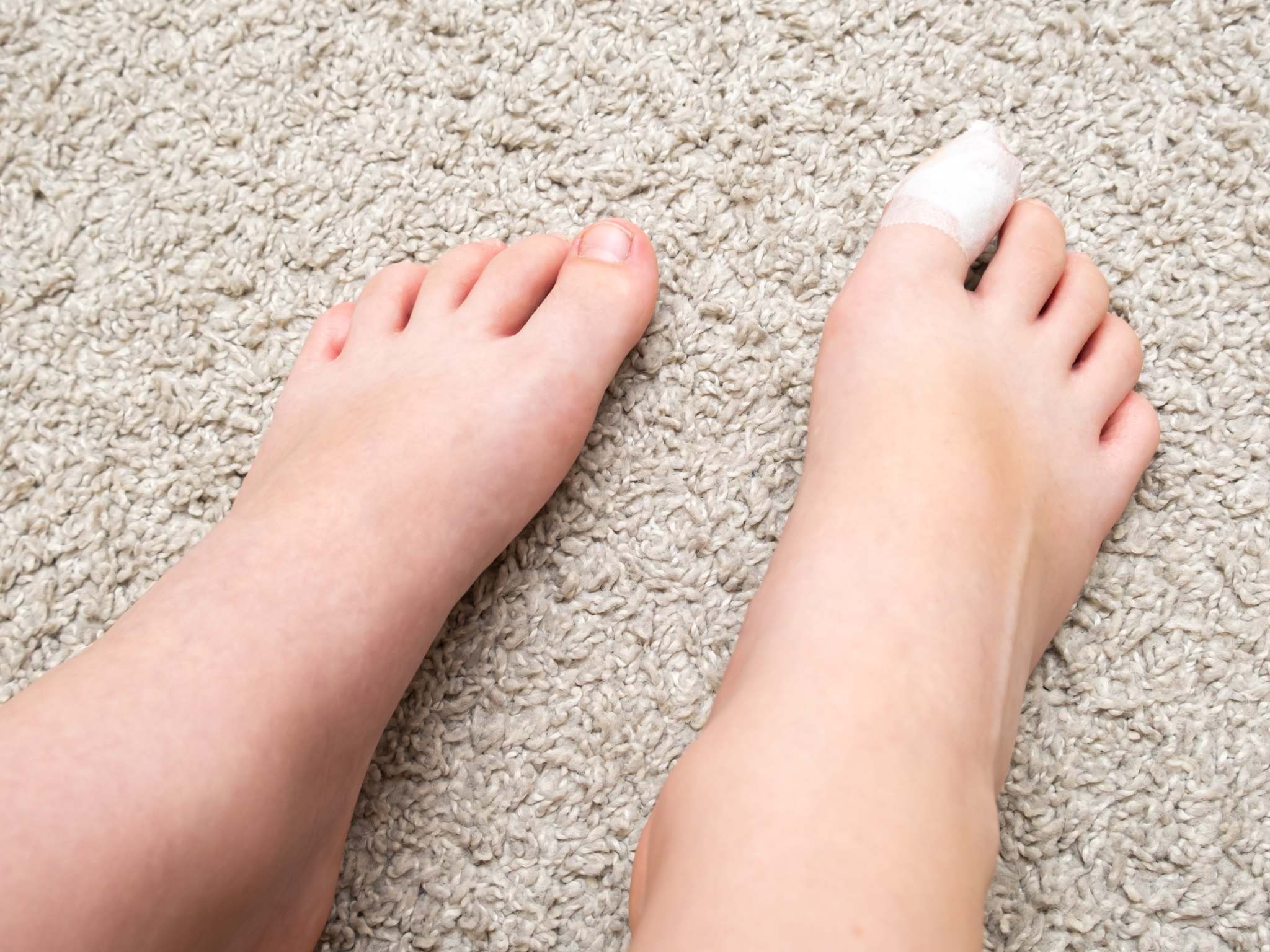 Kid teenager bare feet with a bandage on a toe, wounded toe or ingrown nail first aid