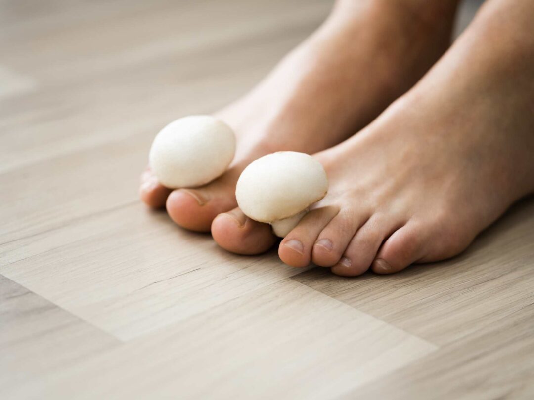 The Best Skin & Nail Care in Colorado Springs McVay Foot & Ankle