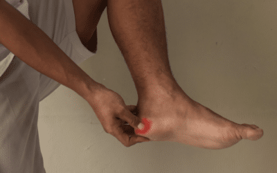 MLS Laser Therapy: A Non-Invasive Solution for Foot and Ankle Pain Relief