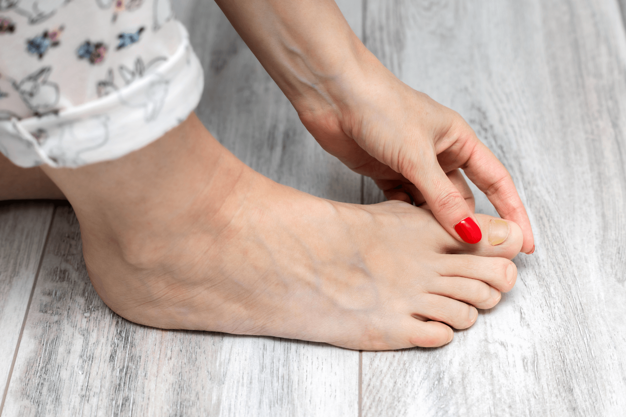 woman examining the discoloration on her big toe