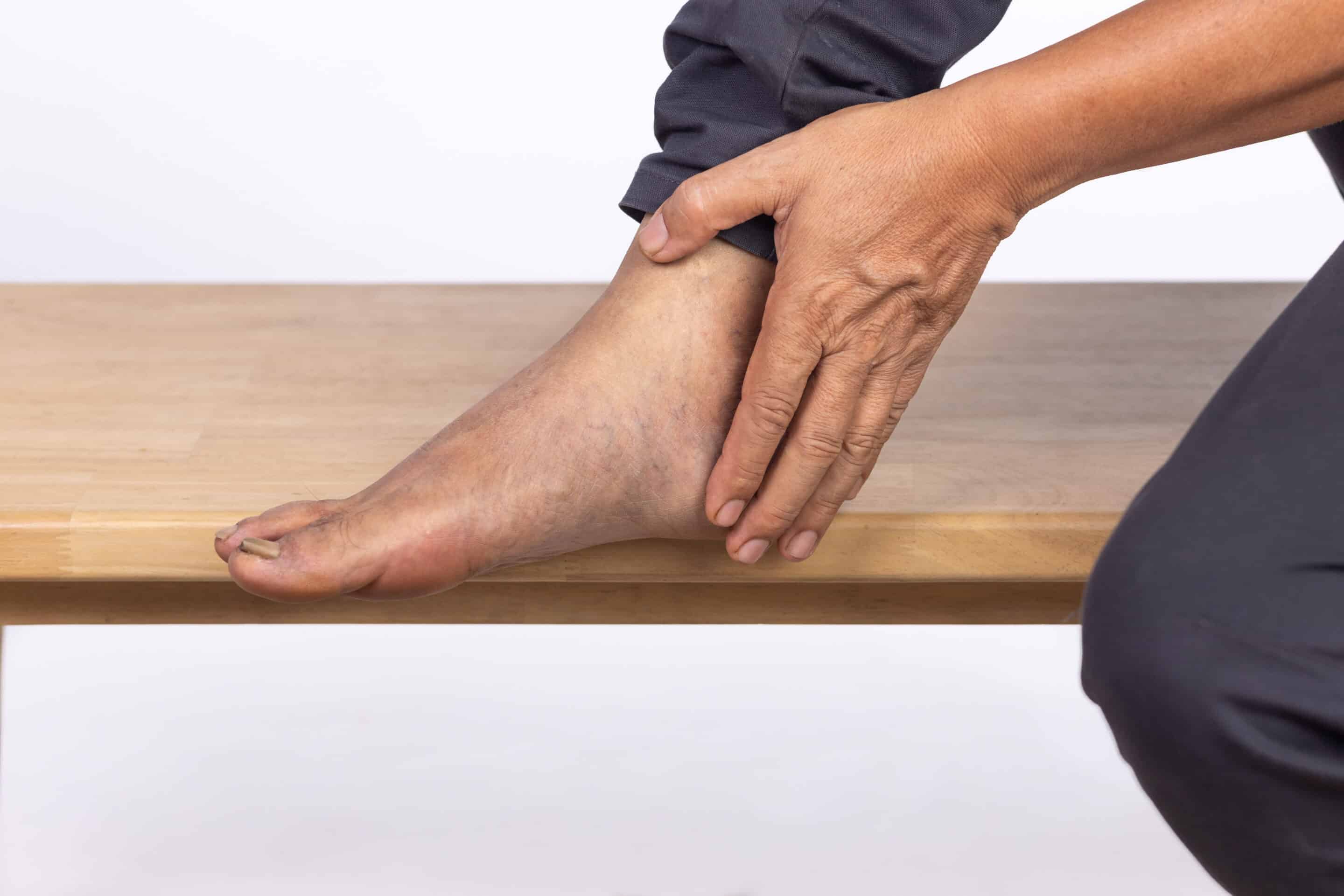 Person touching foot. Diabetic foot concept